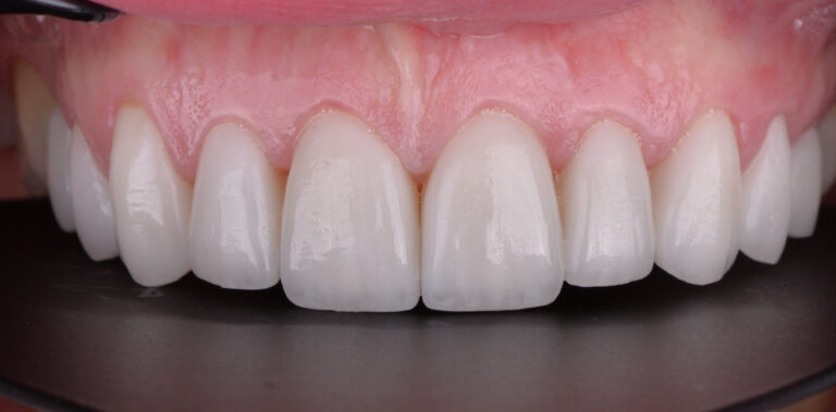 Метаморфоза 23 - po