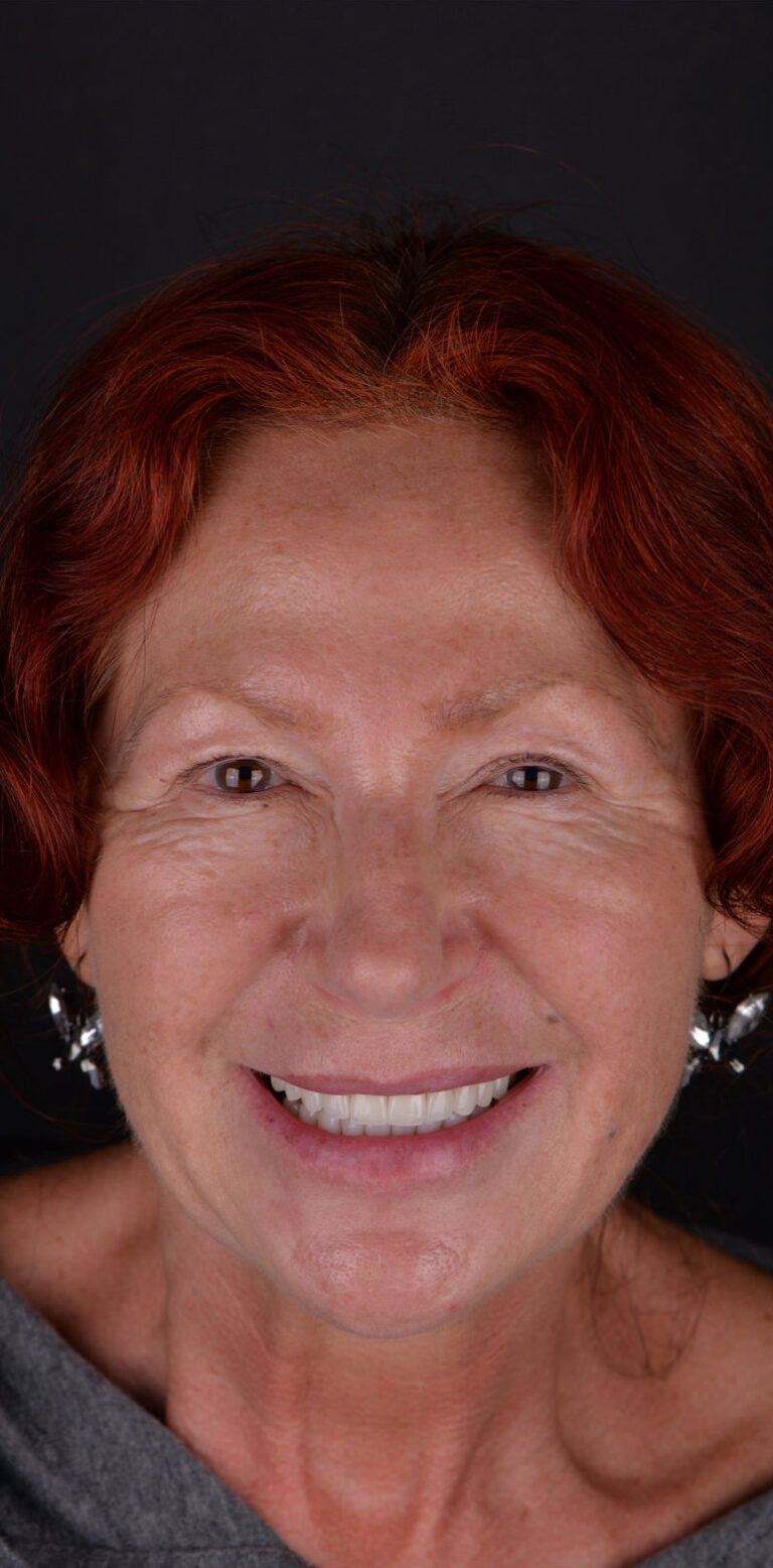 Метаморфоза 105 - po