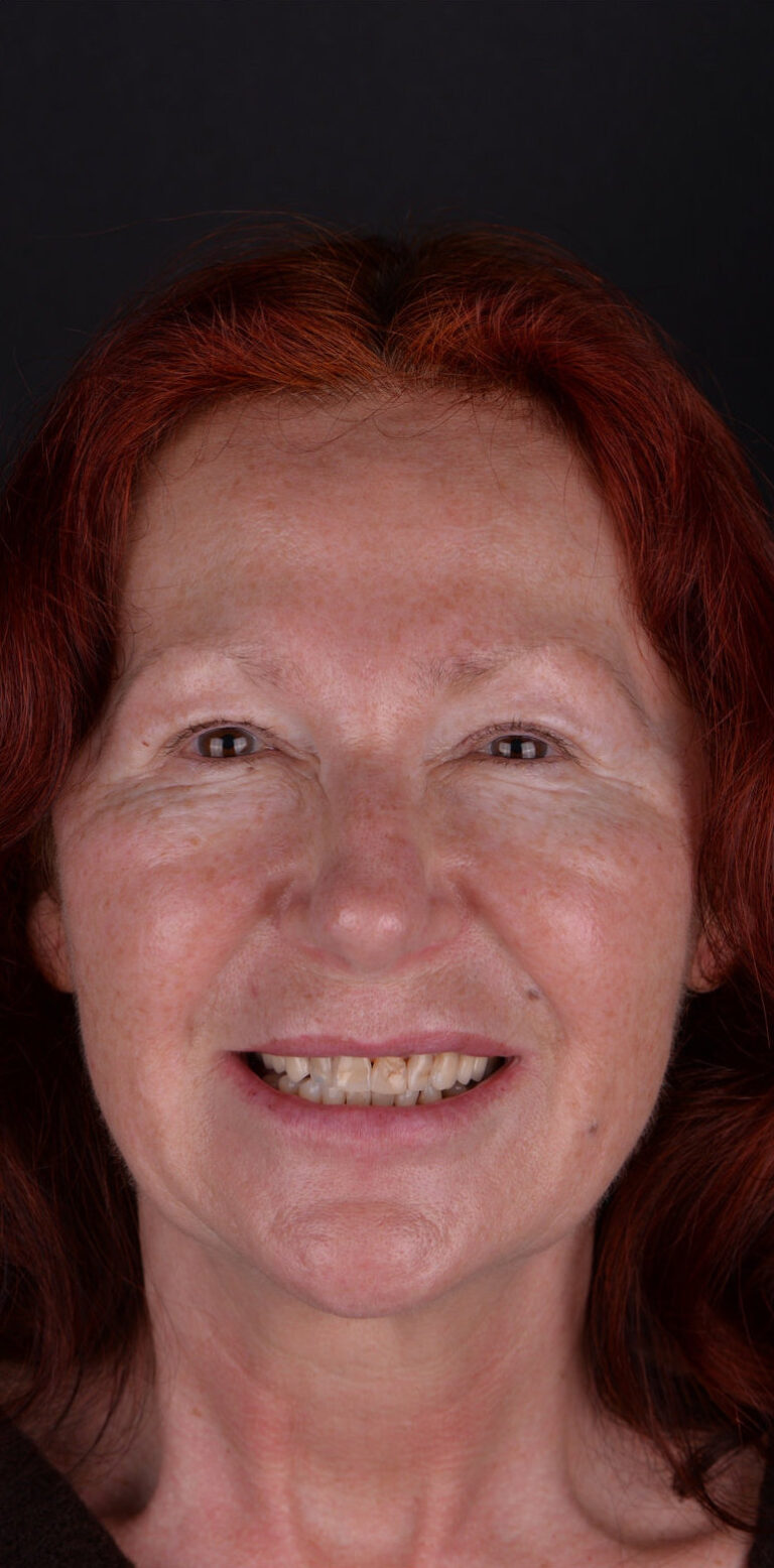 Метаморфоза 105 - przed