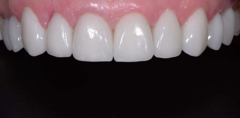 Метаморфоза 93 - po