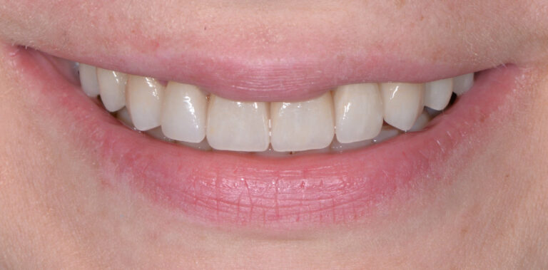 Метаморфоза 79 - po