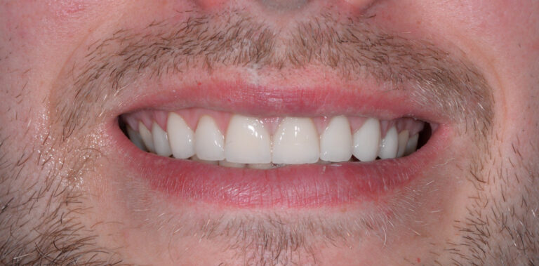 Метаморфоза 87 - po