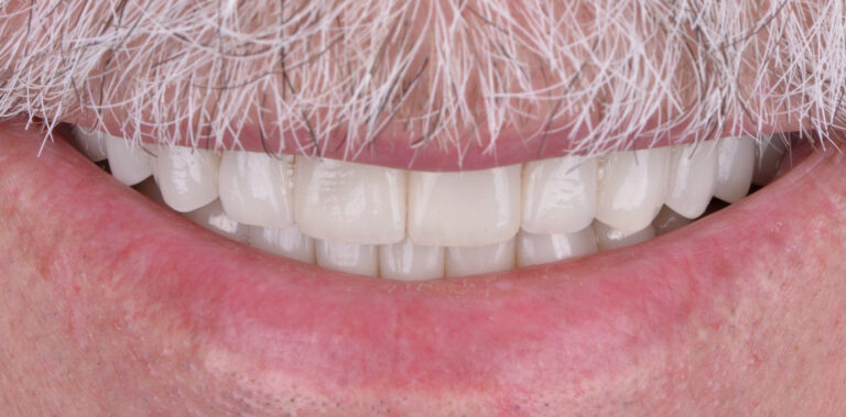 Метаморфоза 64 - po