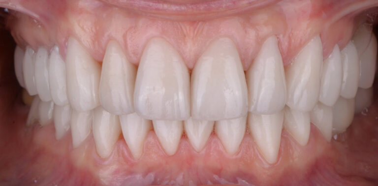 Метаморфоза 38 - po