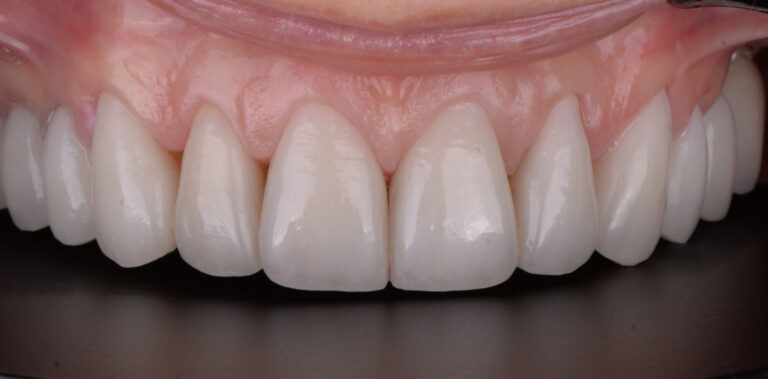 Метаморфоза 37 - po