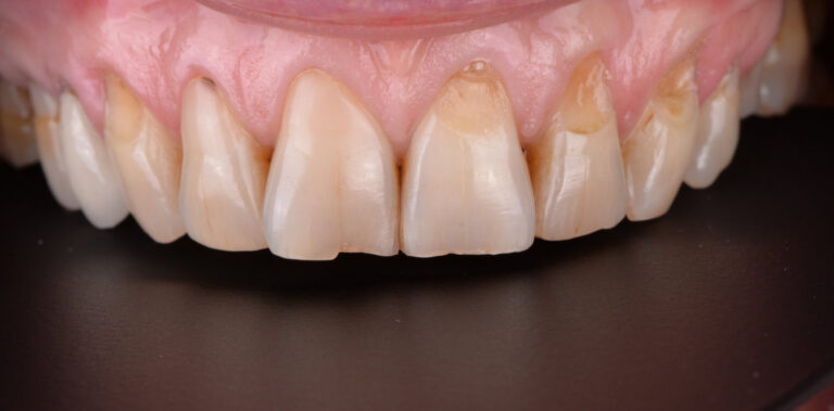 Метаморфоза 37 - przed