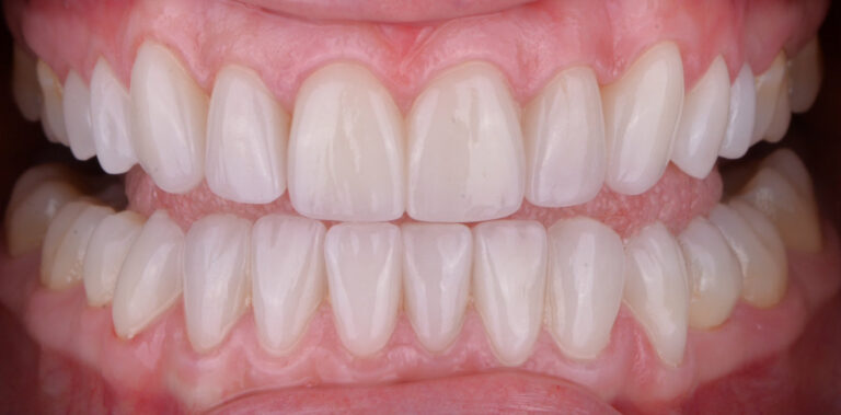 Метаморфоза 2 - po