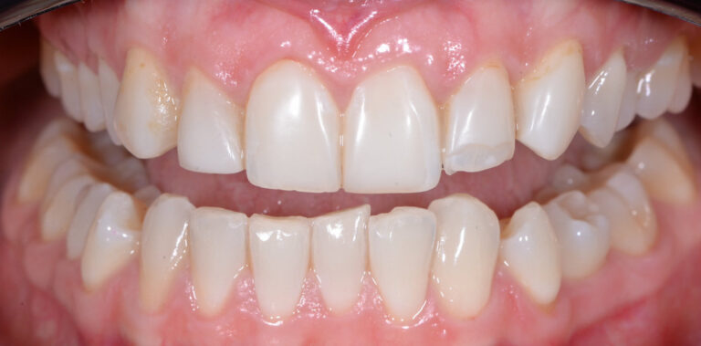 Метаморфоза 2 - przed