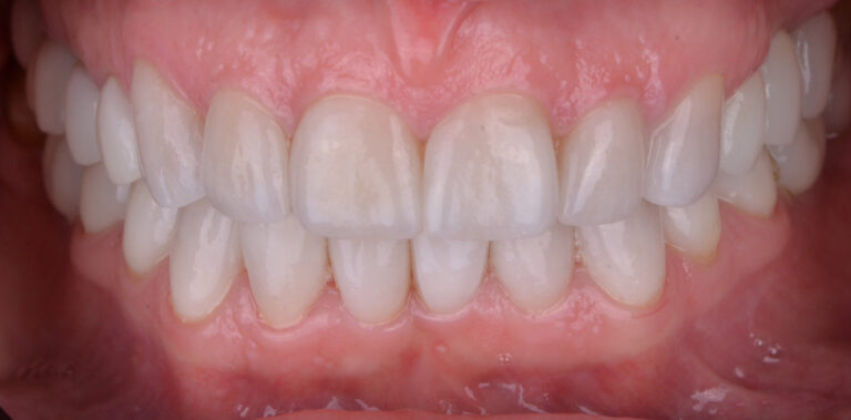 Метаморфоза 6 - po