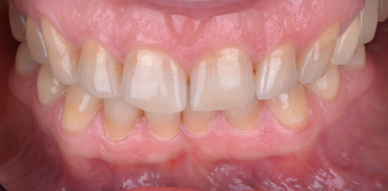 Метаморфоза 6 - przed