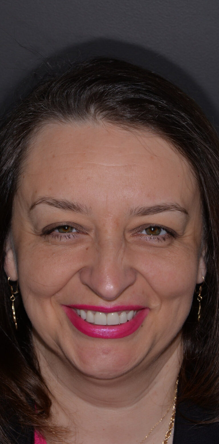 Метаморфоза 109 - po