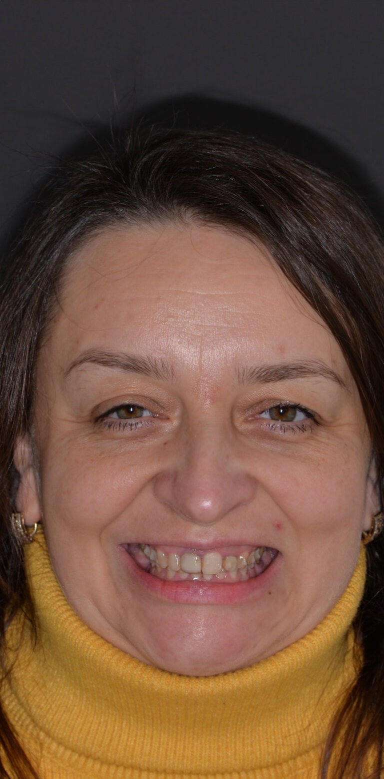 Метаморфоза 109 - przed