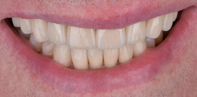 Метаморфоза 88 - po