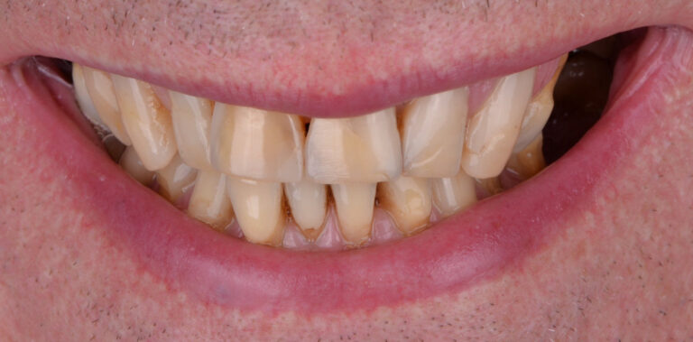 Метаморфоза 88 - przed