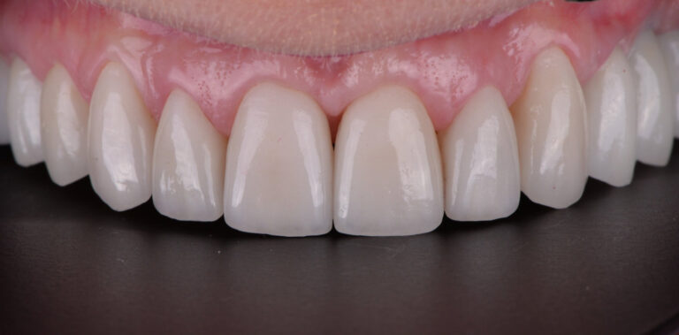 Метаморфоза 49 - po