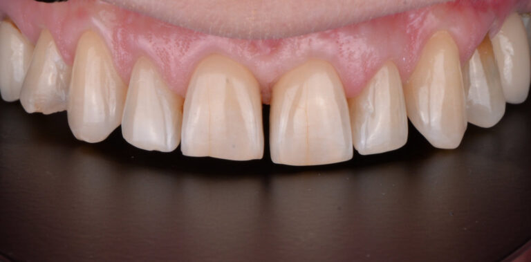 Метаморфоза 49 - przed