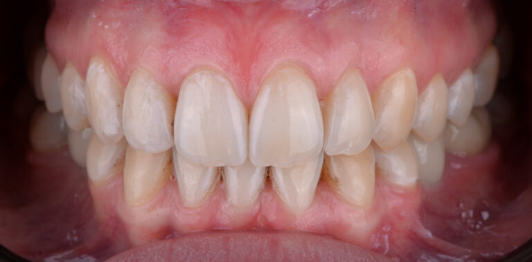 Метаморфоза 63 - po