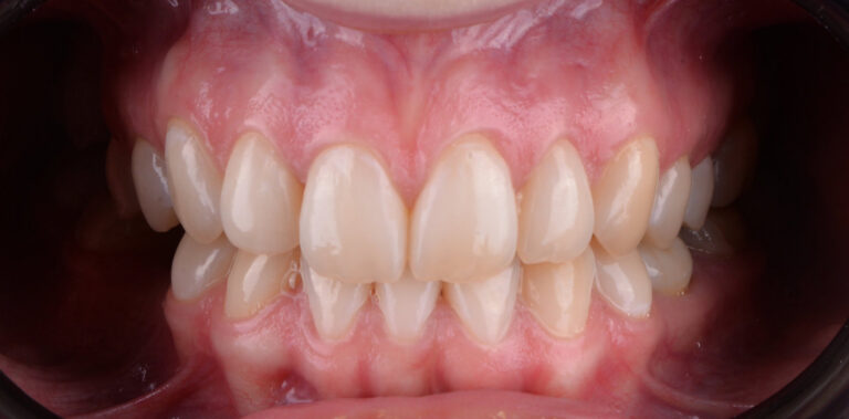 Метаморфоза 63 - przed