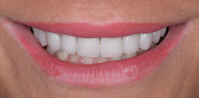 Метаморфоза 92 - po