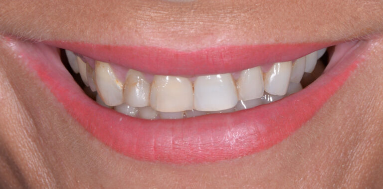 Метаморфоза 92 - przed