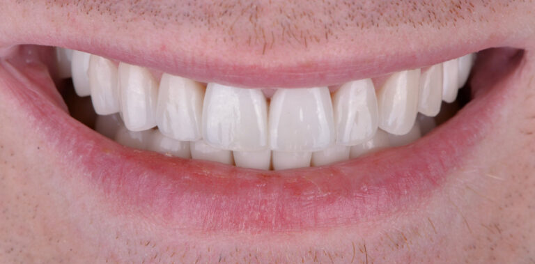 Метаморфоза 54 - po