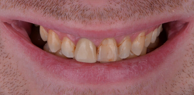 Метаморфоза 54 - przed