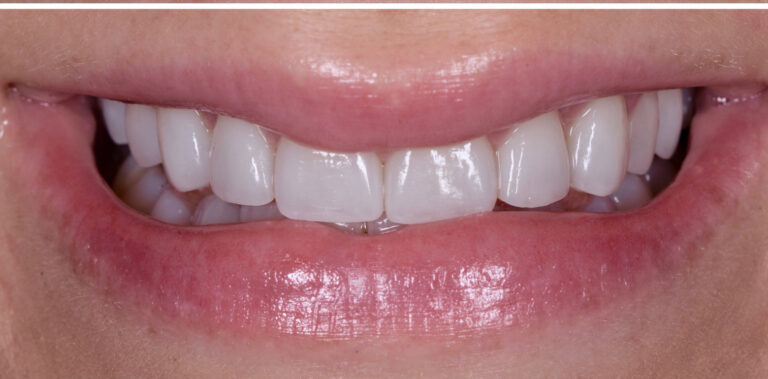 Метаморфоза 17 - po