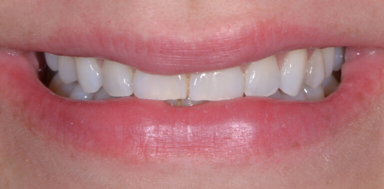 Метаморфоза 17 - przed