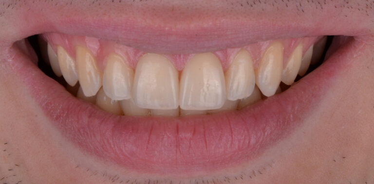 Метаморфоза 3 - po