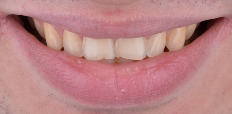 Метаморфоза 3 - przed