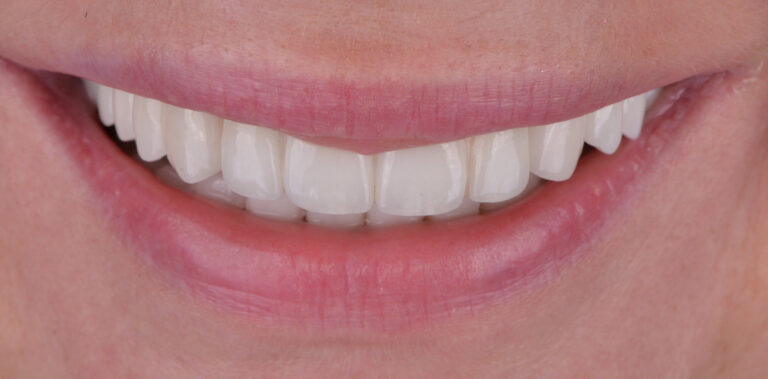 Метаморфоза 65 - po