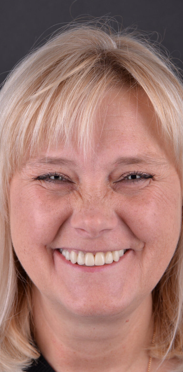 Метаморфоза 103 - przed