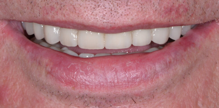 Метаморфоза 43 - po