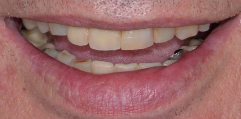 Метаморфоза 43 - przed