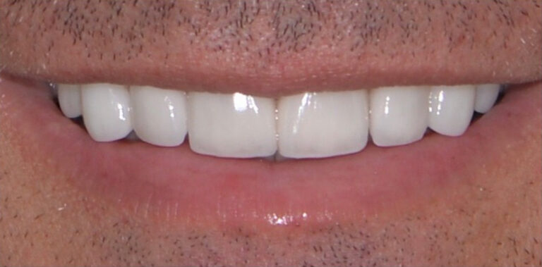 Метаморфоза 84 - po