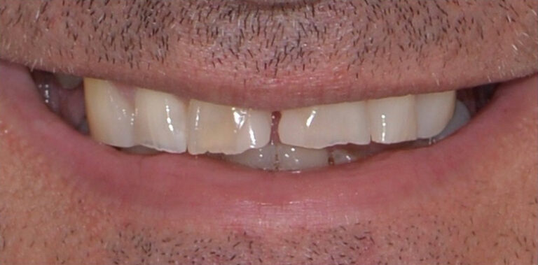 Метаморфоза 84 - przed