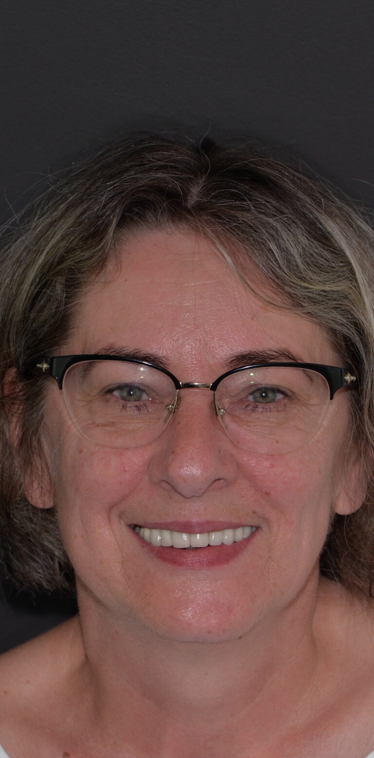 Метаморфоза 108 - przed