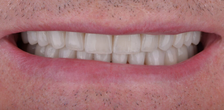 Метаморфоза 34 - po