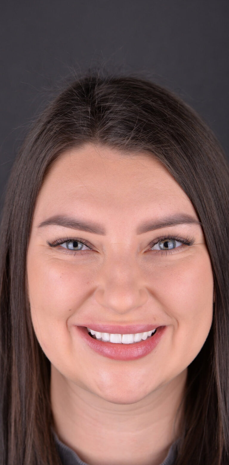 Метаморфоза 102 - po