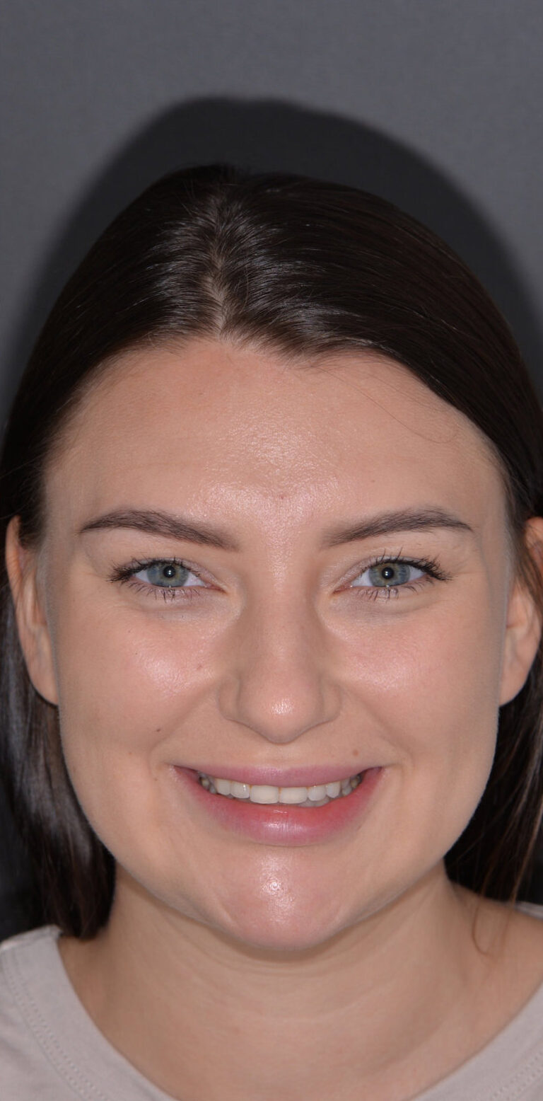 Метаморфоза 102 - przed