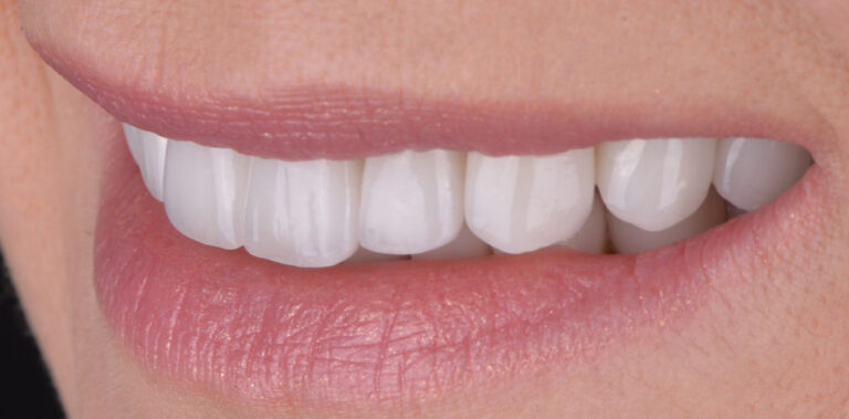 Метаморфоза 21 - po