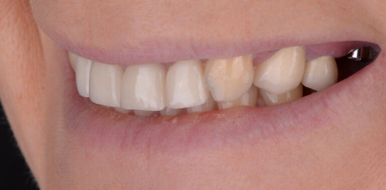 Метаморфоза 21 - przed