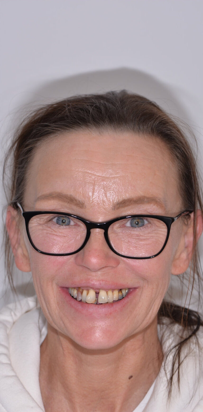 Метаморфоза 101 - przed