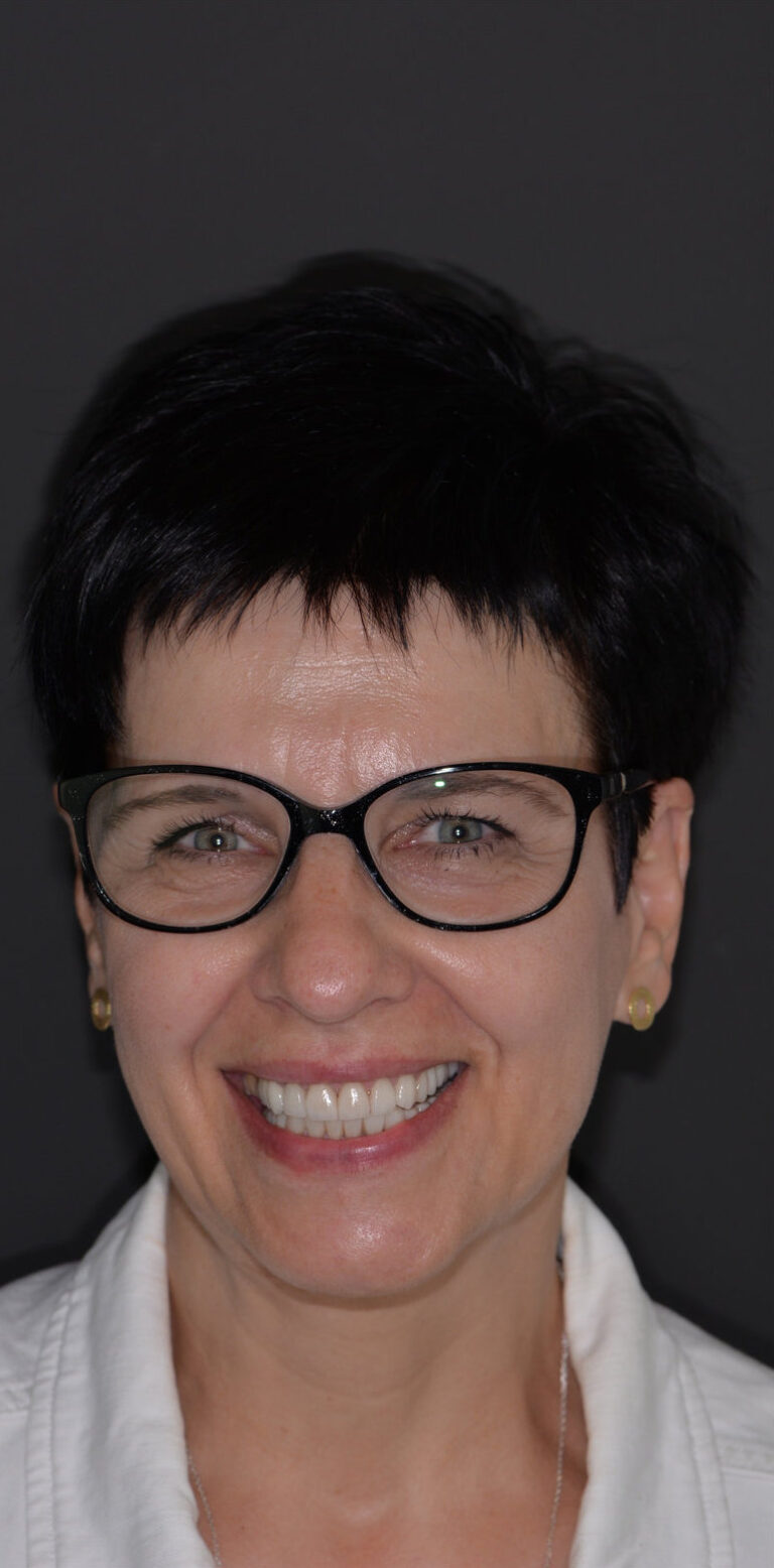 Метаморфоза 100 - po