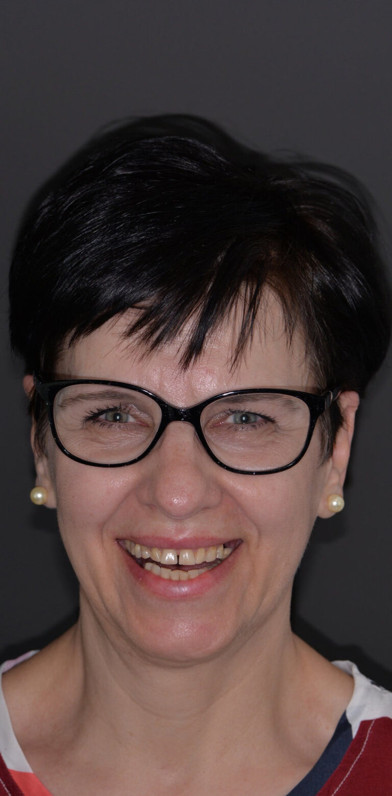 Метаморфоза 100 - przed