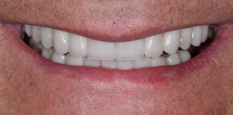 Метаморфоза 16 - po