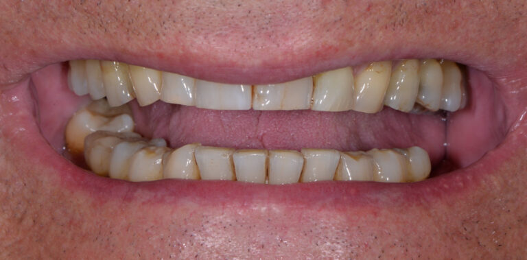 Метаморфоза 16 - przed