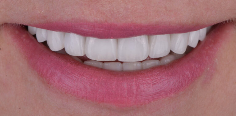 Метаморфоза 58 - po