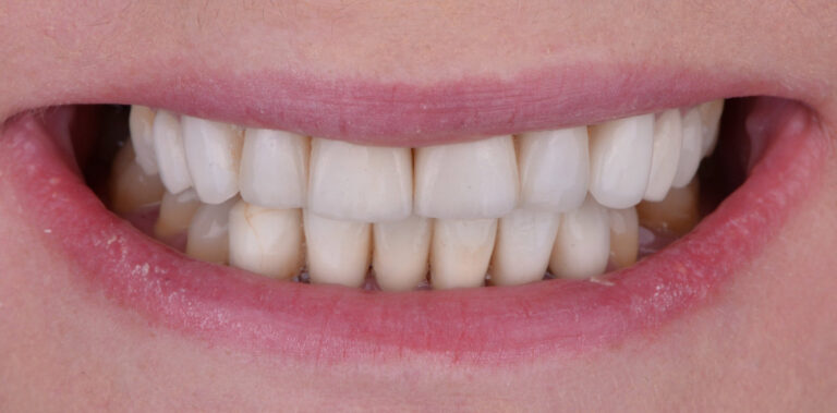 Метаморфоза 58 - przed