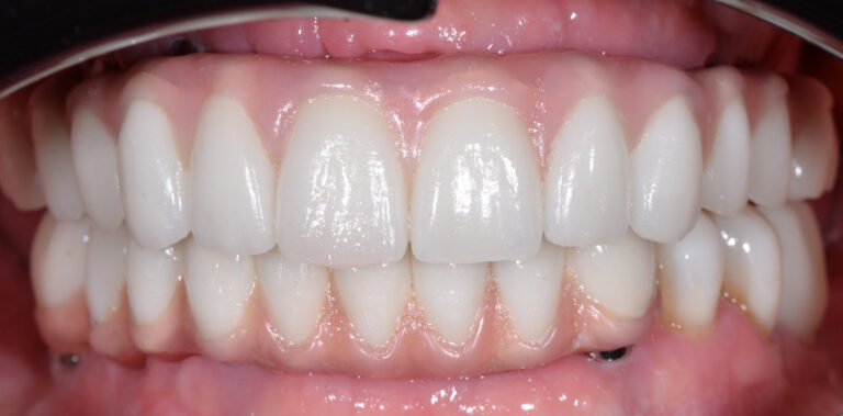 Метаморфоза 42 - po